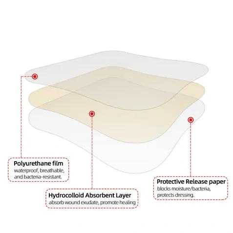 Hydrocolloid pimple patch structure showing backing film, absorbent adhesive layer and removable release liner.