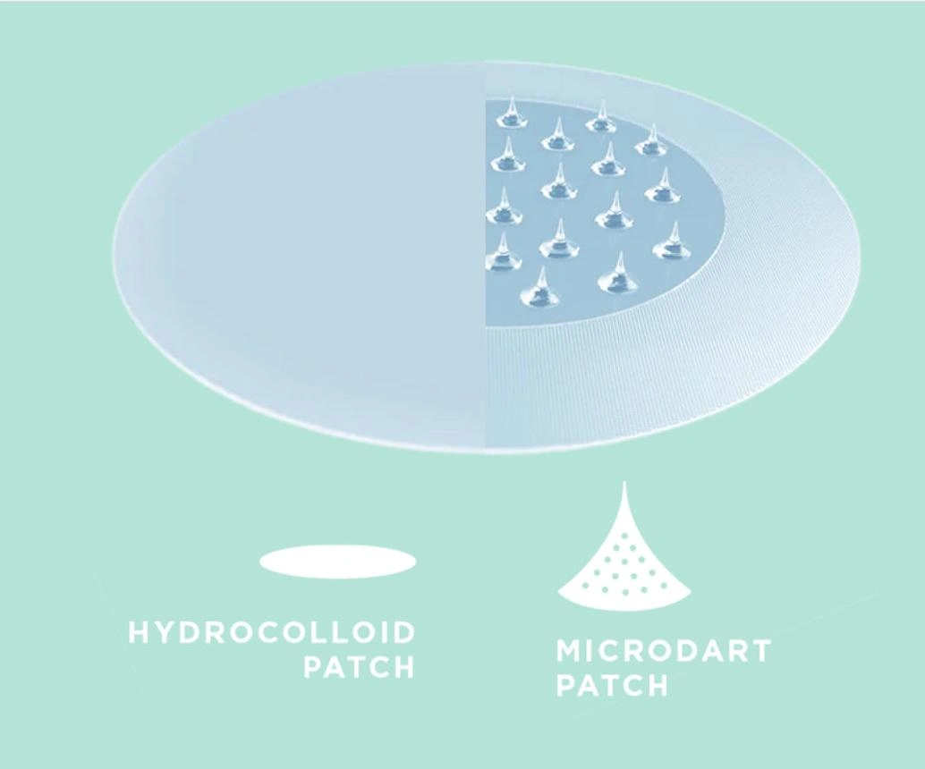 Comparison of hydrocolloid acne patch and dissolvable microdart patch structures.