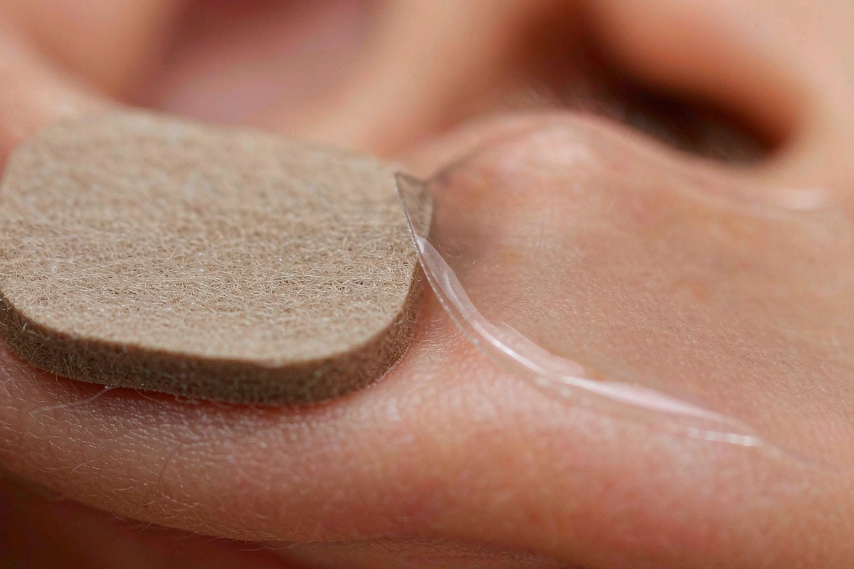 Macro comparison of a thick standard hydrocolloid patch and a thin transparent patch on skin, showing the edge profile difference.